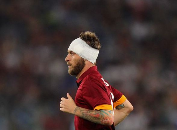 de rossi fasciatura testa Roma-Udinese 17.05.2015